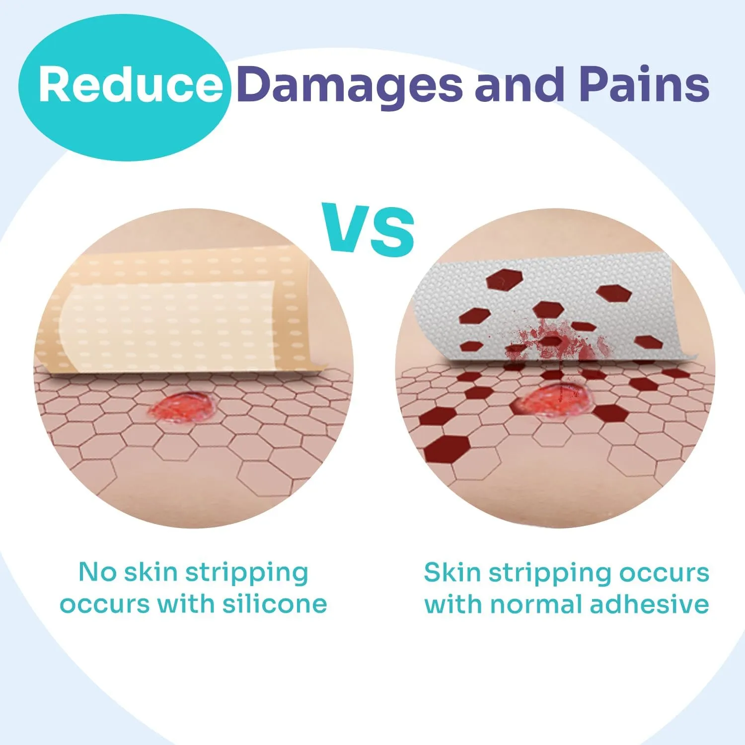 Conkote Silicone Foam Dressings 4'' X 8'', Gentle Adhesive Wound Dressing for Wound Care, Box of 5 Dressings